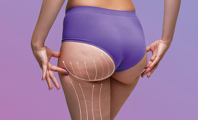 4. Transparent Thigh Lift Costs