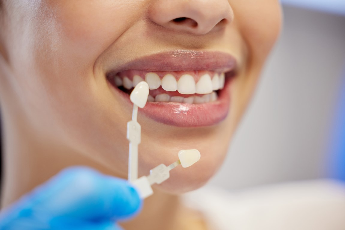 Dentist, cleaning and dental procedure for toothache in clinic, health and treatment for mouth. Teeth whitening, face and person with torque wrench machine, orthodontics and oral care for veneers.