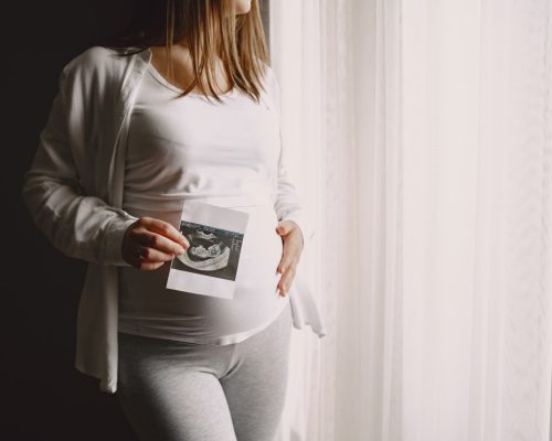 Understanding PCOS: Symptoms, Causes, and Treatment Options