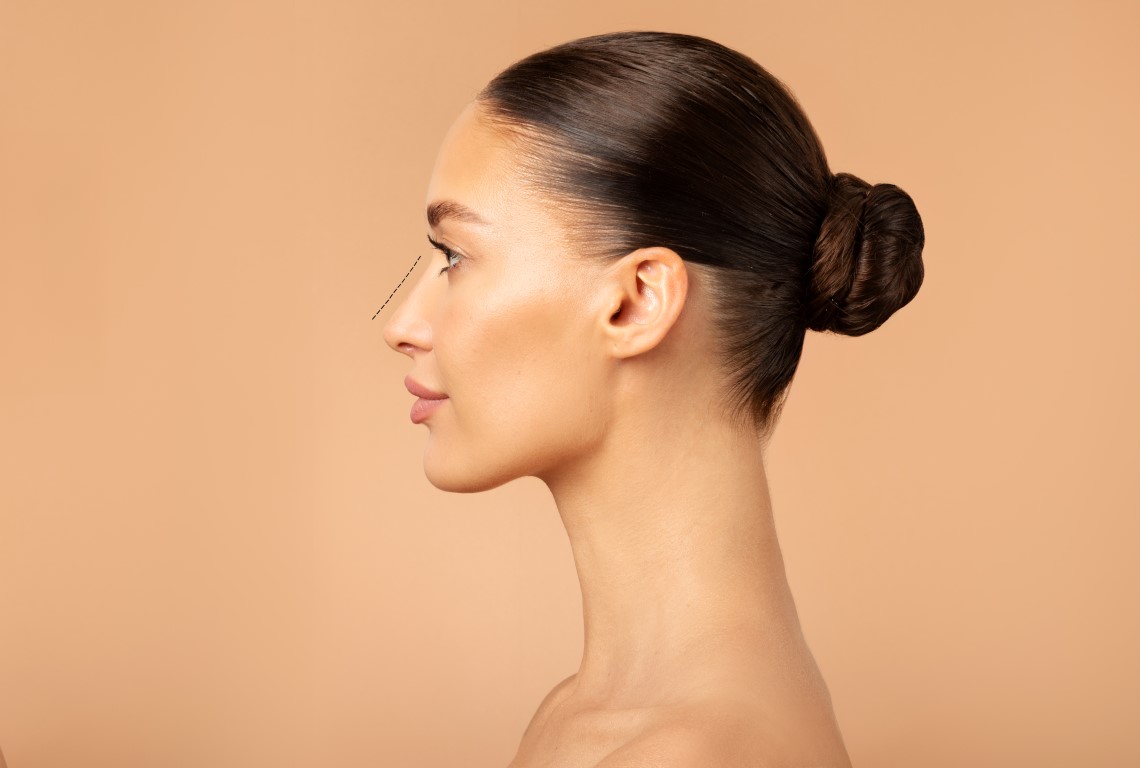 Profile side view of young woman after rhinoplasty operation with perfect nose posing on beige background