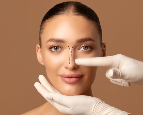 The Ultimate Guide to Rhinoplasty: What to Expect
