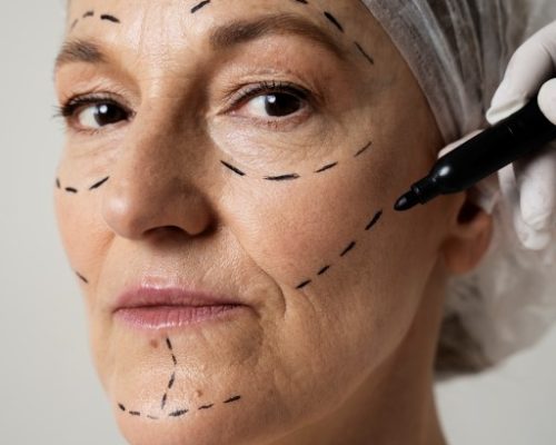 Facelift Surgery: How to Achieve a More Youthful Look